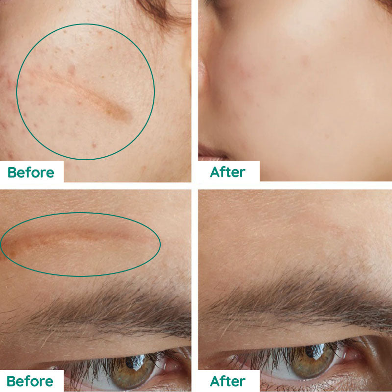 Scar Repair Skin Toner